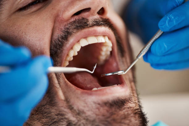 Best Tooth Pain Emergency Relief  in Paloma Creek South, TX