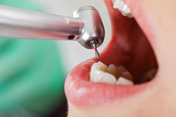 Best Knocked-Out Tooth Emergency  in Paloma Creek South, TX